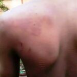 Рабочий показывает раны на спине.