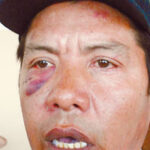 Jesus Antonio Campos Valle, leader of the SNTMMSRM at the Gunderson railcar plant was viciously attacked by several thugs from CTM