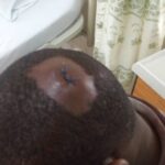 Des travailleurs ont été blessés après une répression brutale de l'armée contre les travailleurs de Tarkwa 